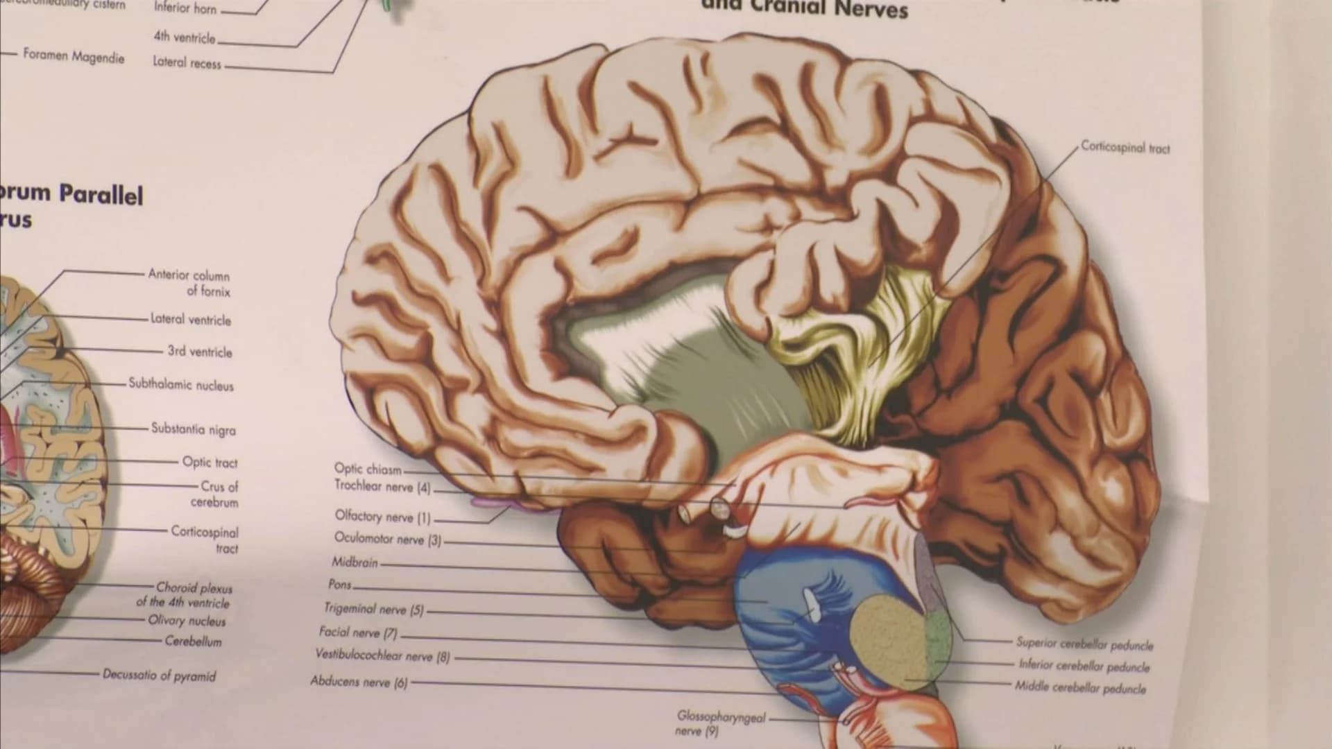 ‘Brain bank’ study hopes to better understand opioid addiction
