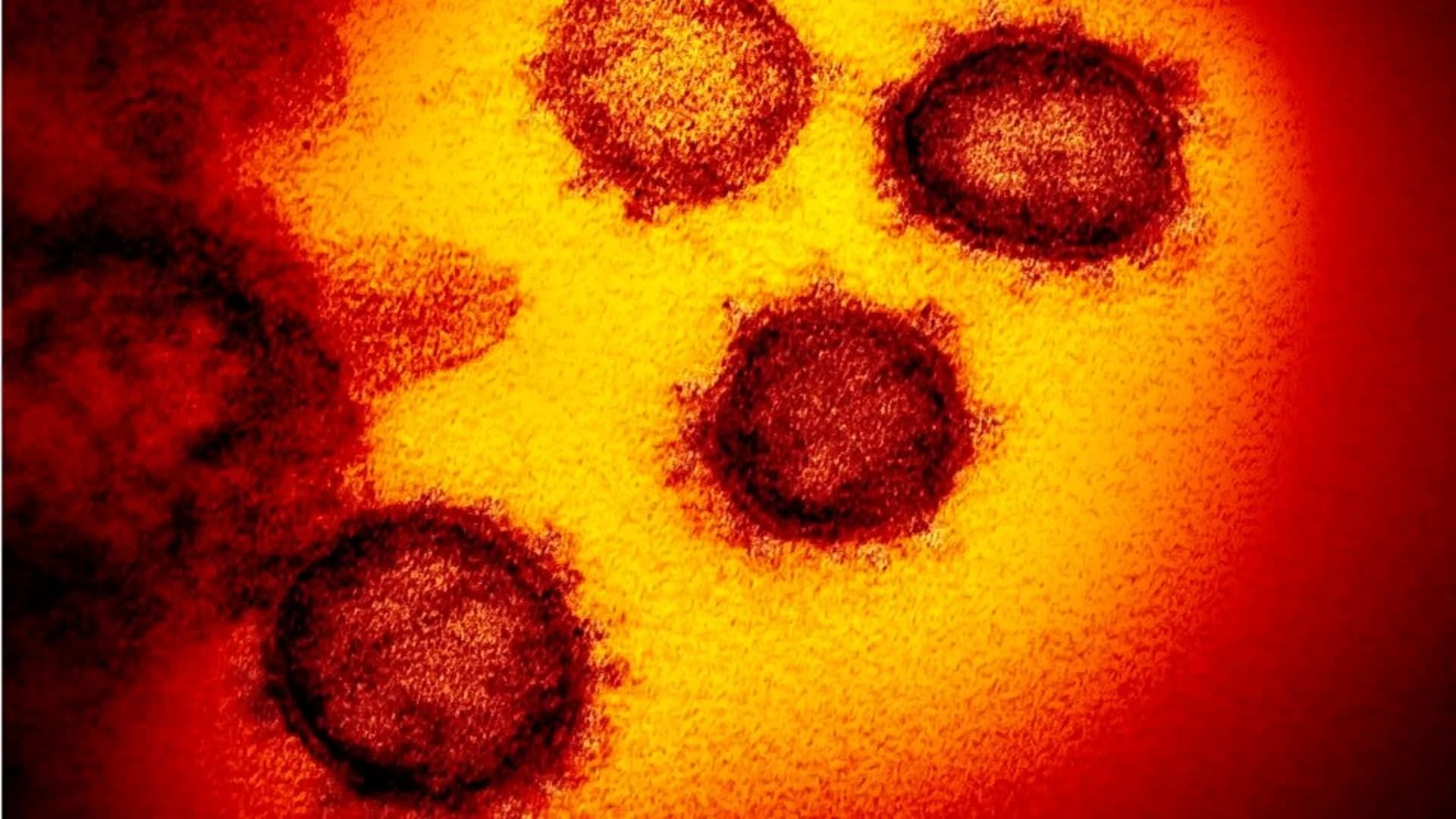1st child in NYC dies from coronavirus